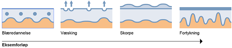 Eksemforløp