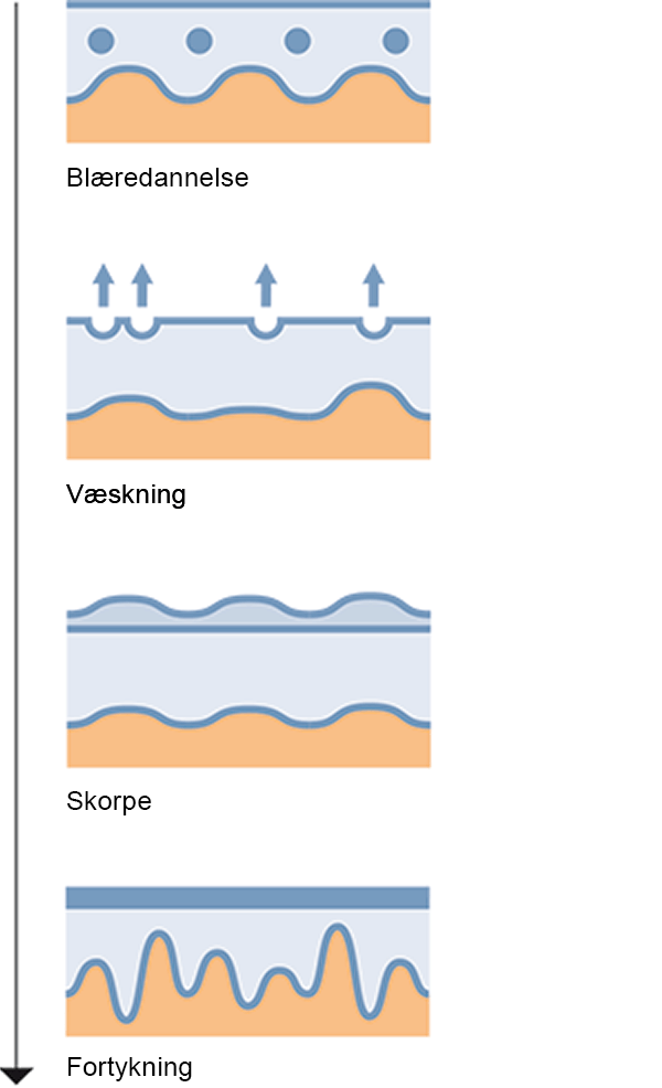 Eksemforløp